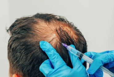 serviceIiHZ81MU